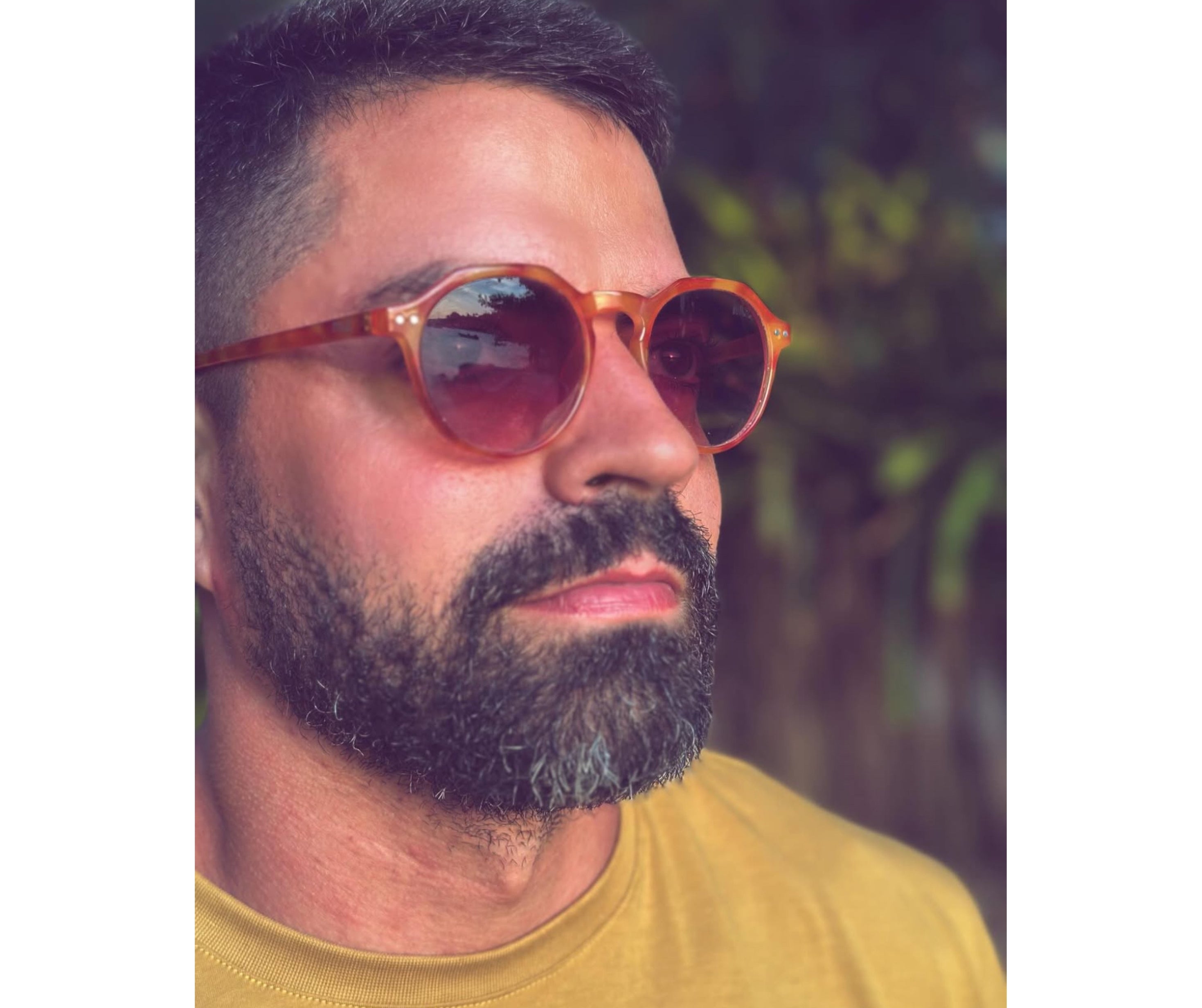 Acessórios